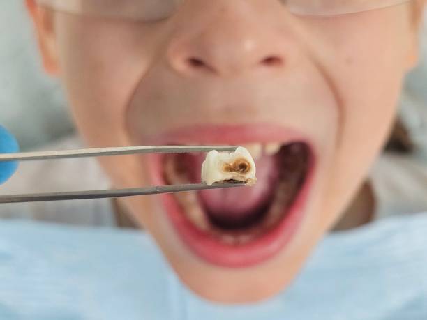 Best After-Hours Emergency Dentist in Poplar Plains, CT